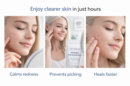 CLEARSKIN™ Invisible Acne Repair Patch – Fast, Clean & Discreet Spot Treatment